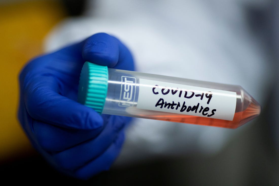 what happens if you test positive for covid antibodies